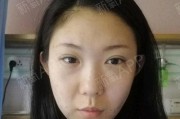 手机拍照效果不佳如何改善？
