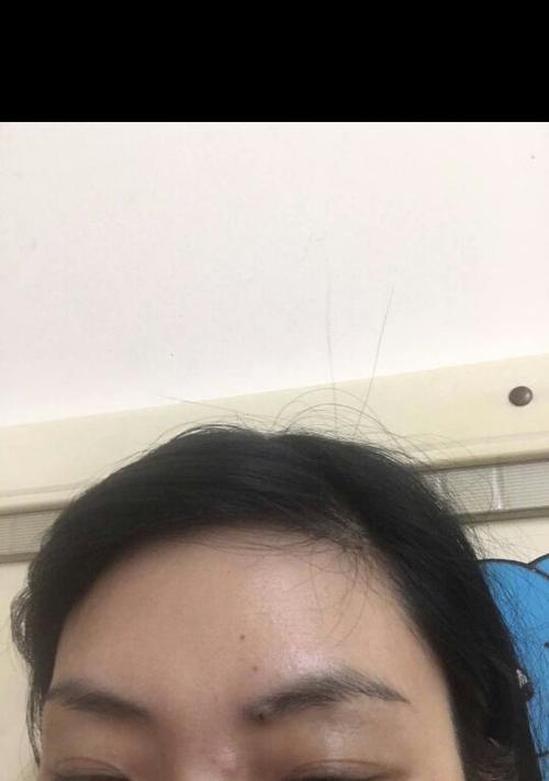 如何减掉脸上的肉（有效方法帮助你塑造精致小脸）