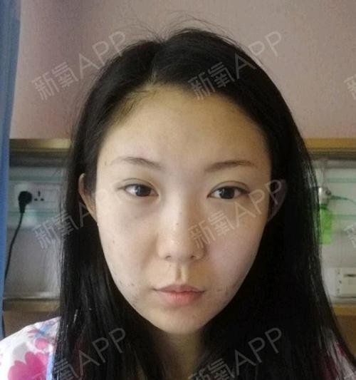 手机拍照效果不佳如何改善？