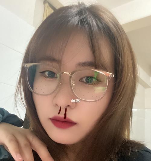 轻颜雀斑相机如何在手机上使用？使用时需要注意什么？