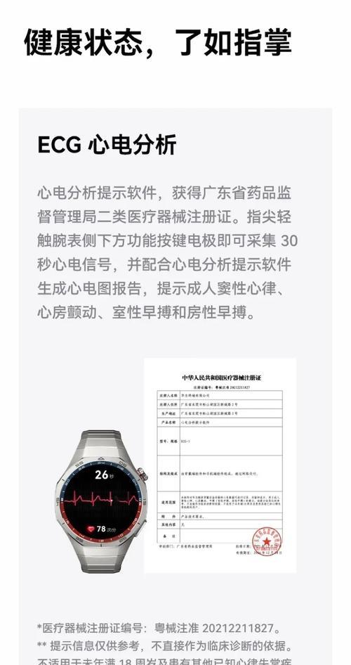 智能手表带淡黄色代表什么？