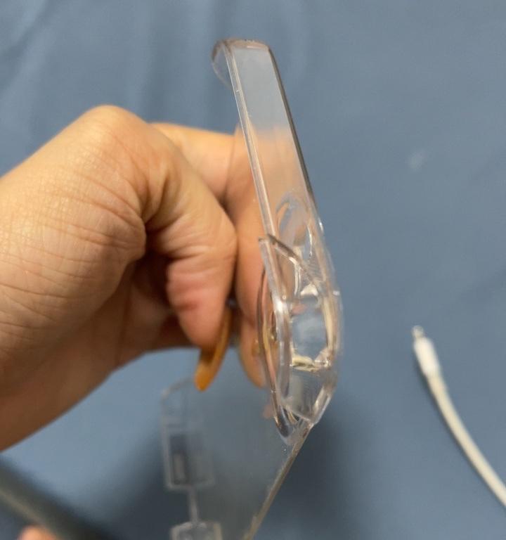 手机壳塞入手机箱后如何拆卸？有简便方法吗？